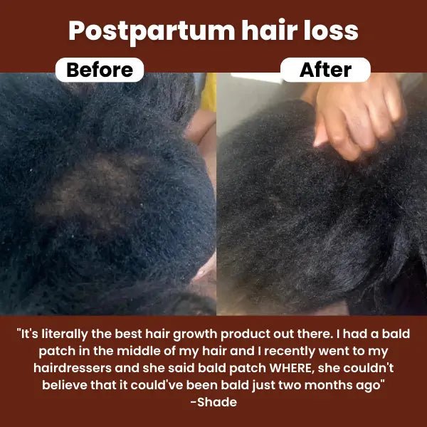 "This oil made my hair thicker, longer & healthier." - Arianna E - Veefre