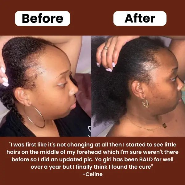 "This oil made my hair thicker, longer & healthier." - Arianna E - Veefre