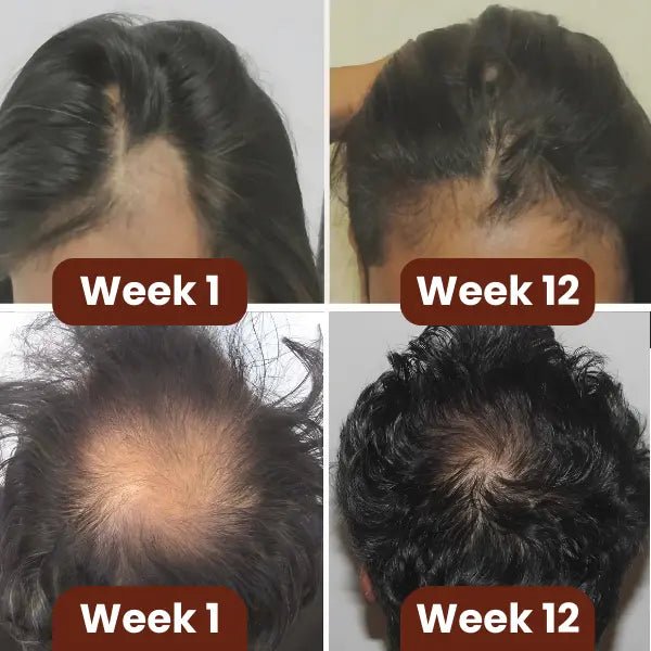 "This oil made my hair thicker, longer & healthier." - Arianna E - Veefre